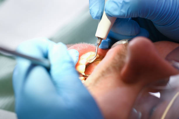 Best Urgent Care for Lost Fillings or Crowns in Winterville, GA